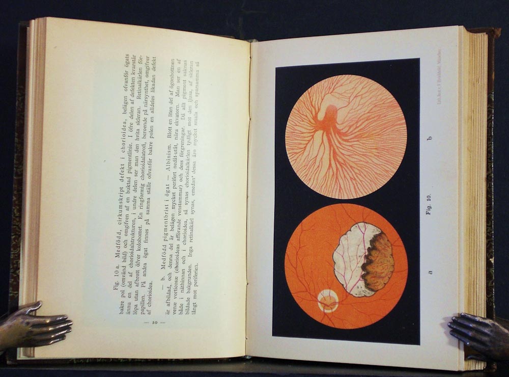 Haab, O.: Oftalmoskopisk atlas jämte handledning i oftalmoskopi och oftalmoskopisk diagnostik (1898)